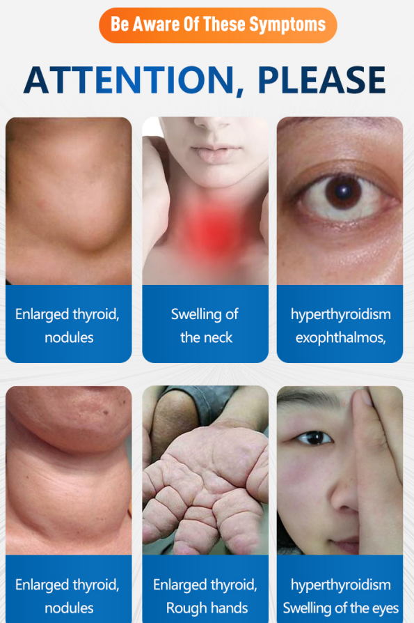 Thyroid patch manufacturer wholesale2.png