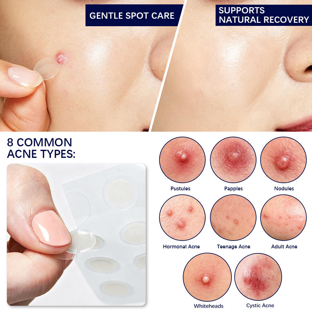 Acne Spot Hydrocolloid Patch 36 Count Fragrance Free Vegan Cruelty Free Ultra Thin Invisible Overnight Blemish Cover OEM